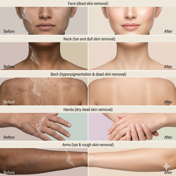 Sea Beauty Dead Skin Remover Exfoliating Gel | Face & Body Exfoliator | Removes Dead Skin, Tan & Hyperpigmentation | Boosts Natural Glow & Smooth Texture